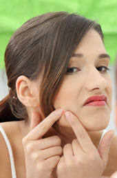  teenage woman with pimple